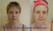 Шикарный омолаживающий комплекс